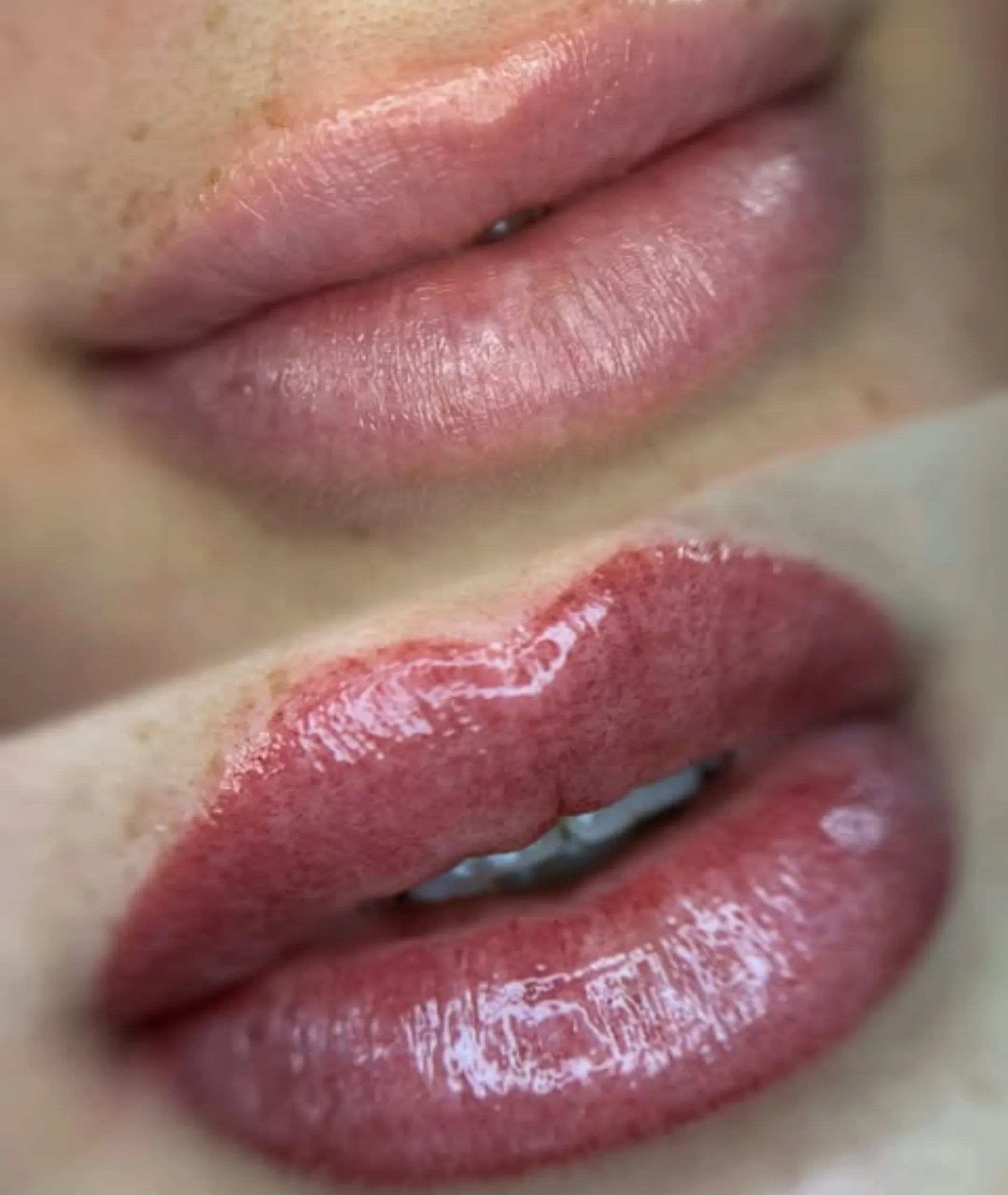cosmetic tattoo correction cost