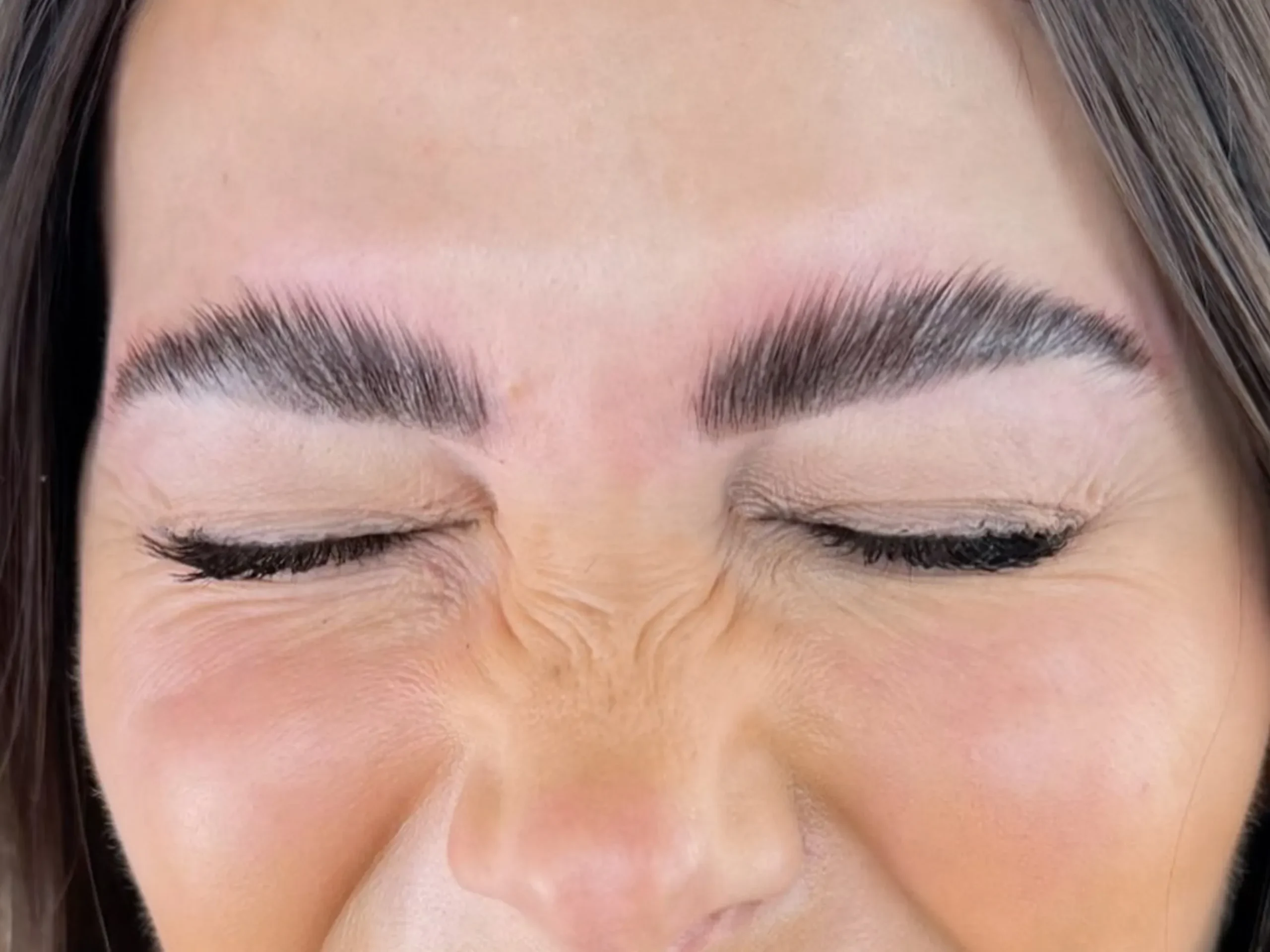 cosmetic tattoo removal vs cover up